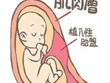  【健康】胎盘“扎根”子宫造成产妇大出血，我院医护团队“出手”迅速止血还保住了子宫 